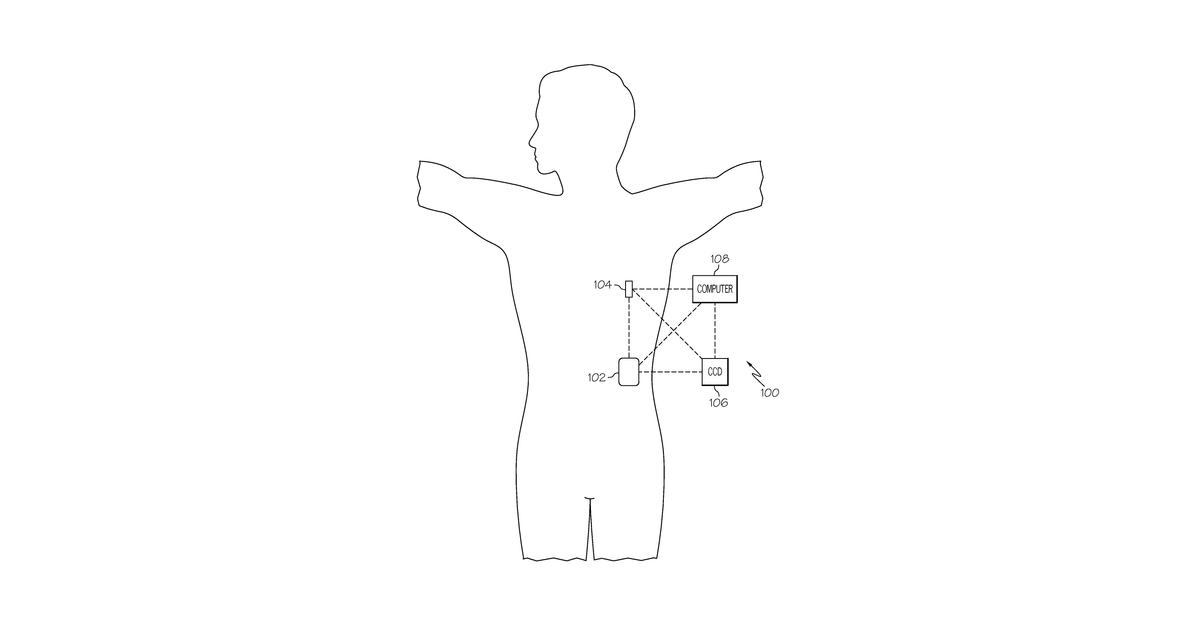 Patent drawing for Infusion devices with distributed motor control and related operating methods