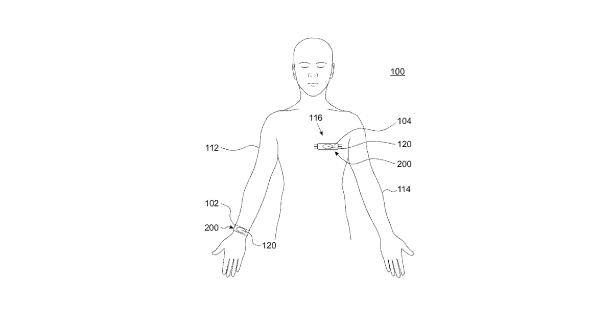 Patent drawing for Wearable apparatus for ECG signal acquisition