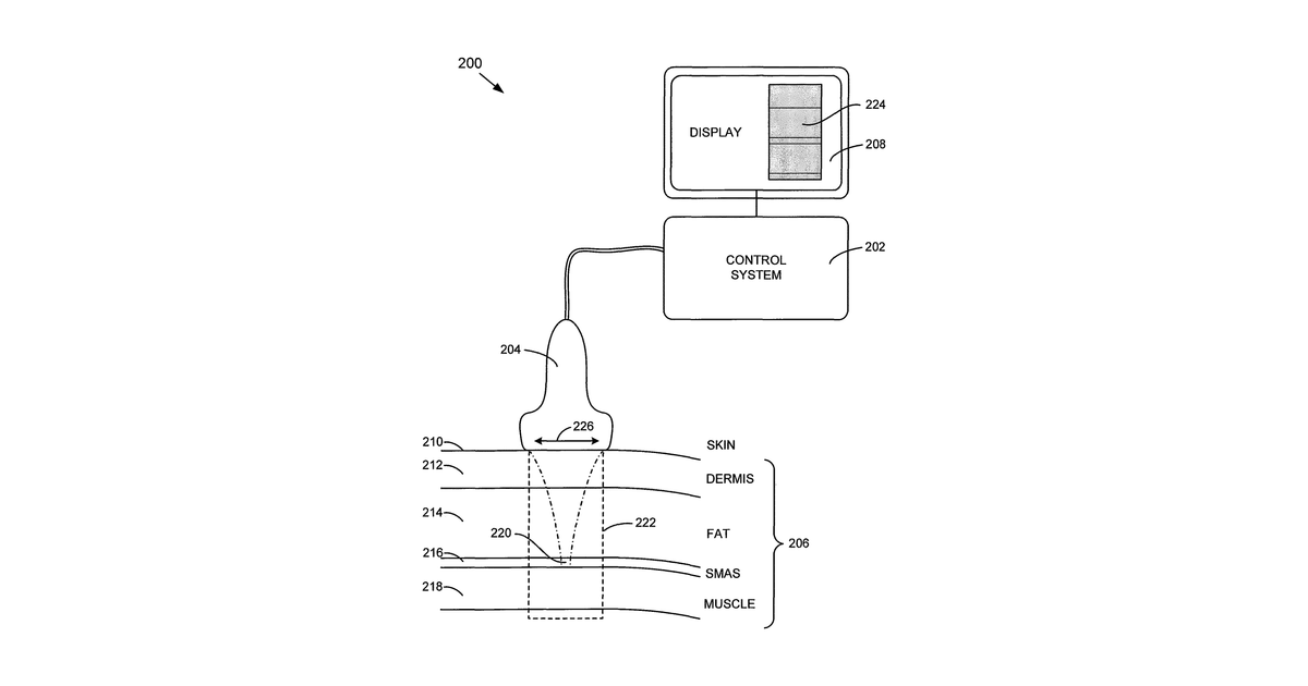 Patent drawing for System and method for noninvasive skin tightening