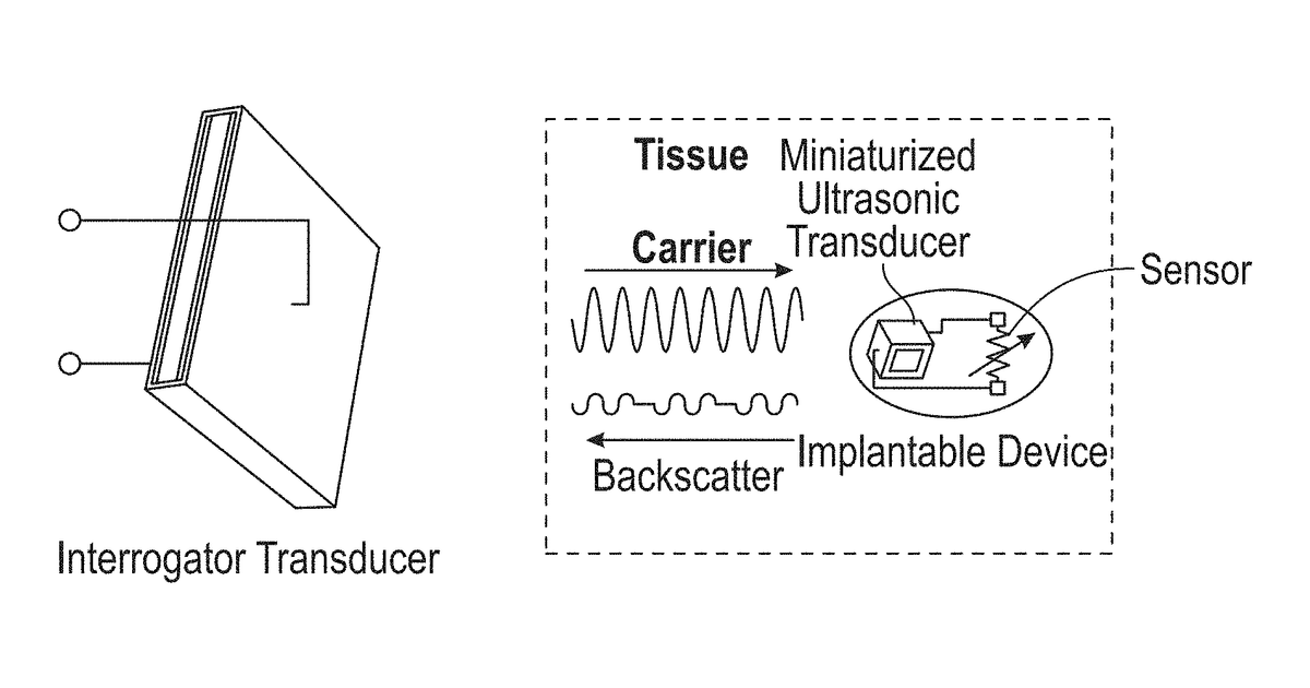 Patent drawing for Implants using ultrasonic backscatter for sensing physiological conditions
