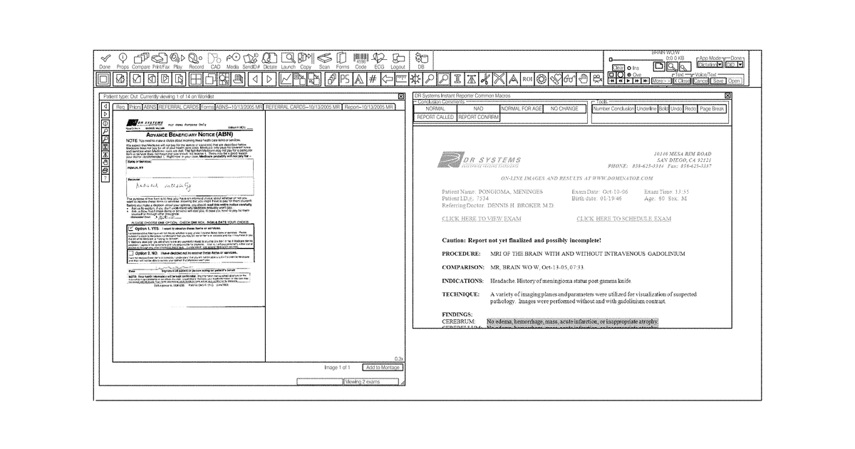 Patent drawing for Dynamic montage reconstruction