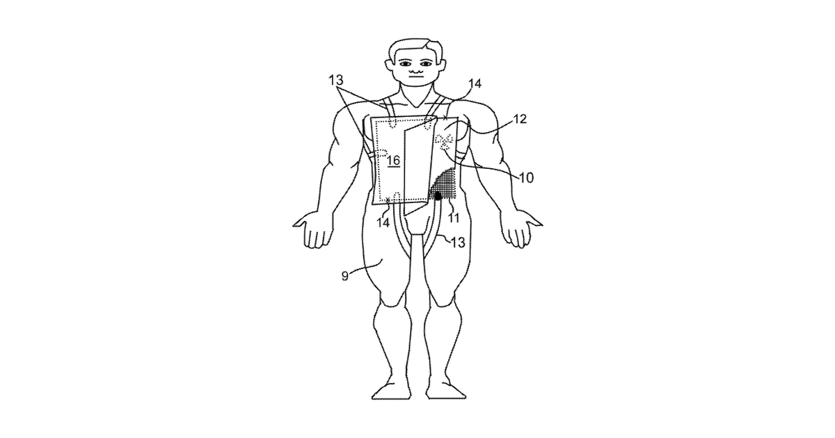 Patent drawing for System for detecting stent slippage, method for detecting stent slippage