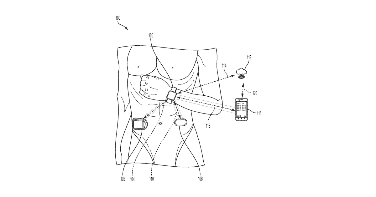 Patent drawing for Wearable automated medication delivery system