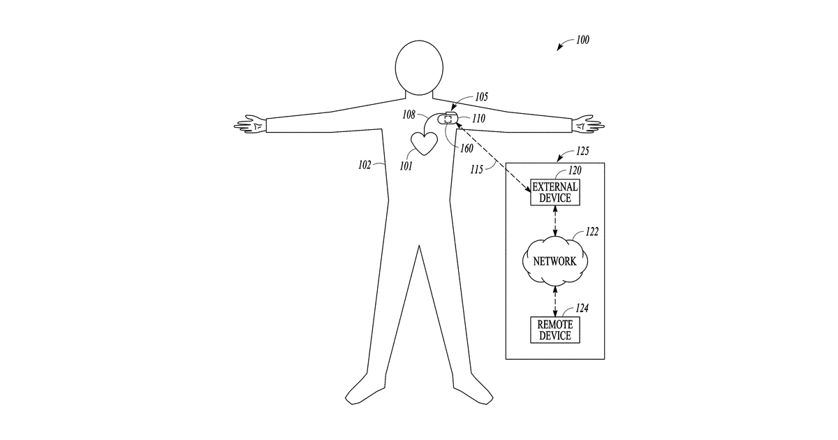 Patent drawing for Heart failure stratification based on respiratory pattern