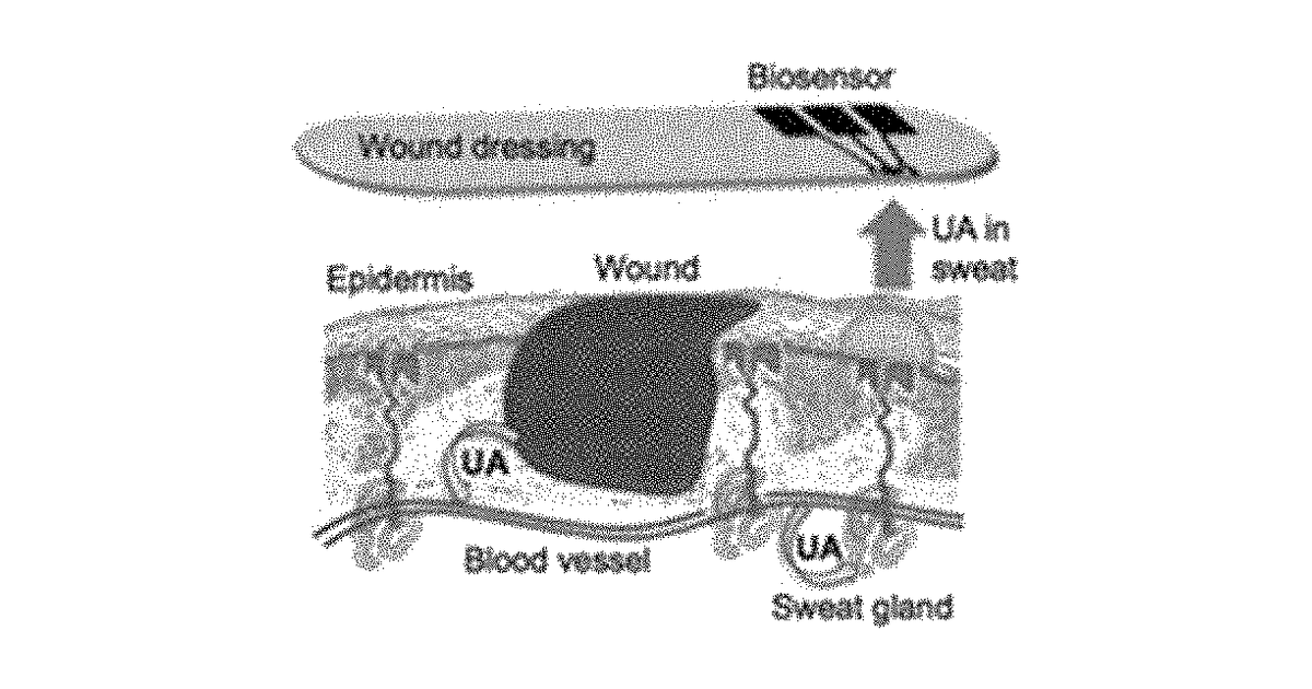 Patent drawing for Wound monitoring sensors and use thereof