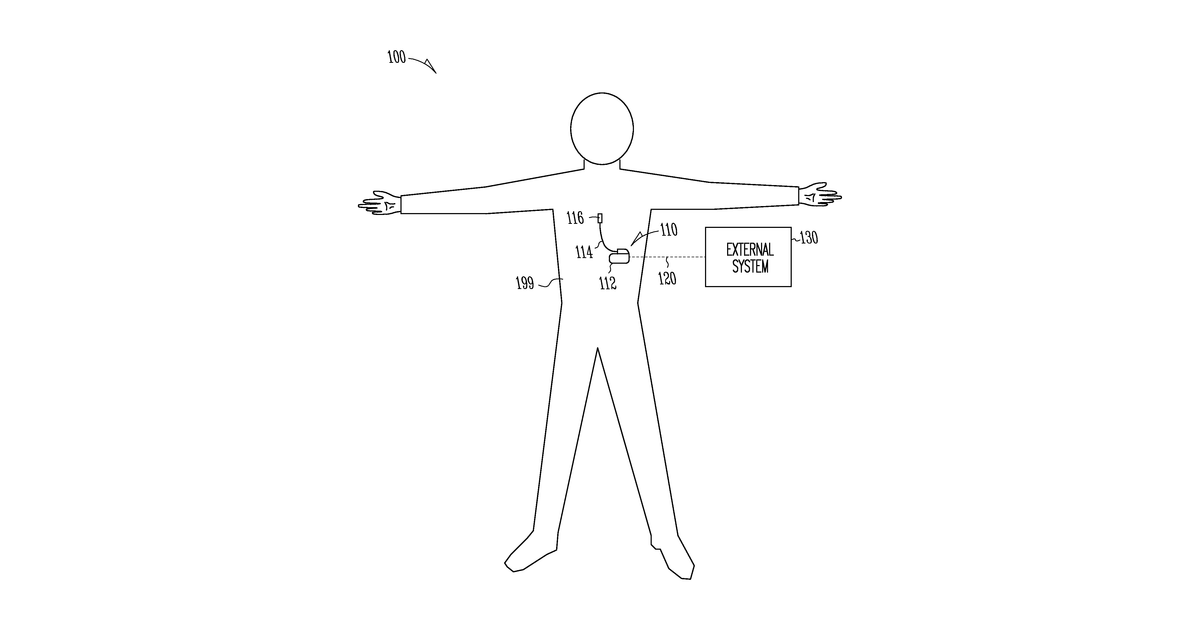 Patent drawing for Sensor-based pain management systems and methods