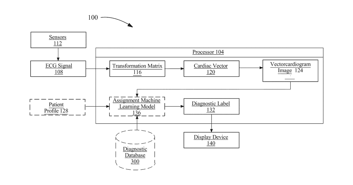 Patent drawing for Apparatus and a method for the improvement of electrocardiogram visualization