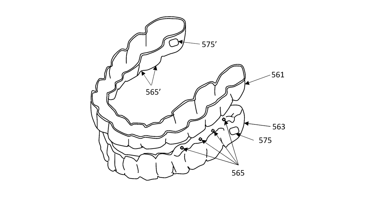 Patent drawing for Sensors for monitoring oral appliances