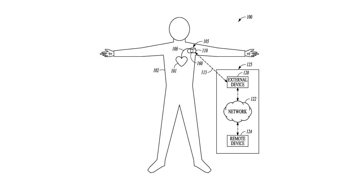 Patent drawing for Heart failure monitor using gait information