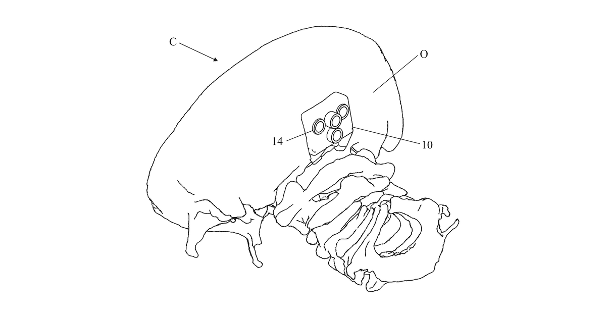 Patent drawing for Patient-matched apparatus for use in robotic assisted surgical procedures and methods for using the same