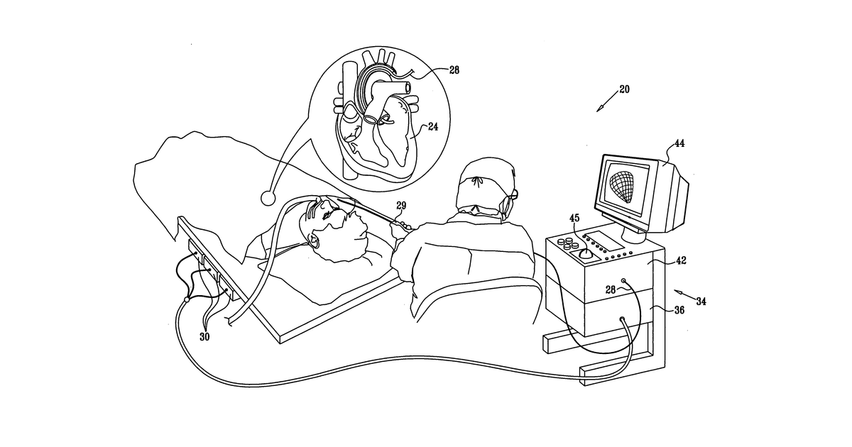 Patent drawing for Software product for three-dimensional cardiac imaging using ultrasound contour reconstruction