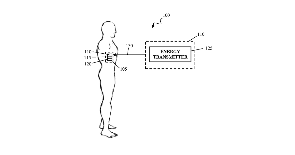 Patent drawing for Thermal Management of Implantable Medical Devices