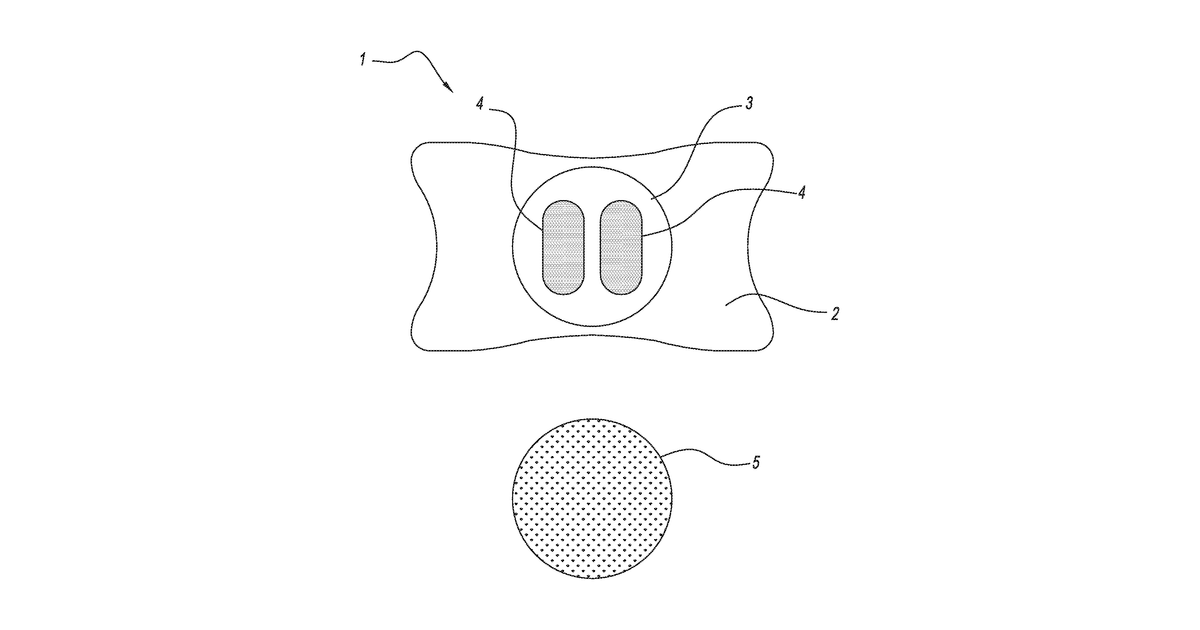 Patent drawing for Oral engagement instruments, retainer systems, and uses thereof