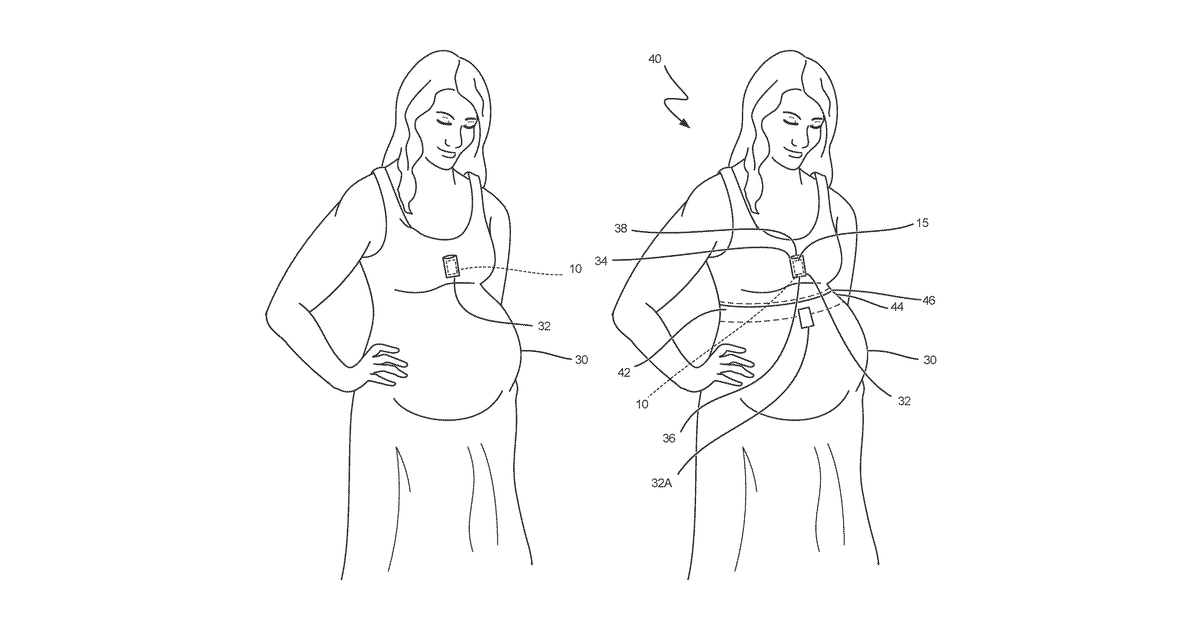 Patent drawing for Systems, devices, and methods for tracking abdominal orientation and activity for treatment and prevention of pressure sores