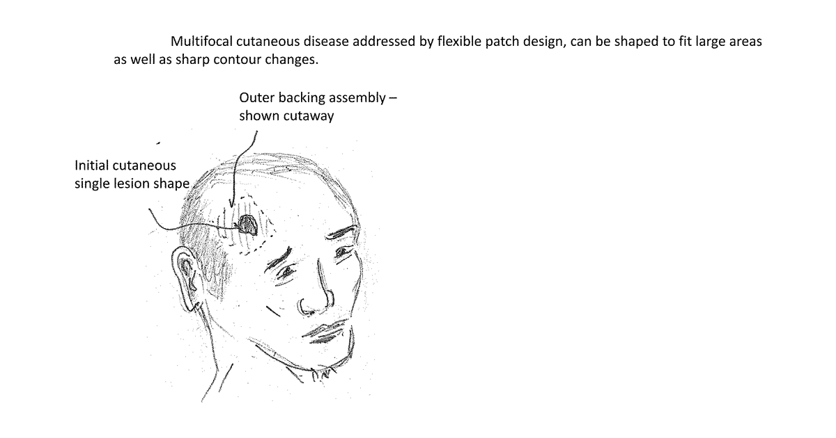 Patent drawing for Optimization of Radionuclides for Treatment of Cutaneous Lesions