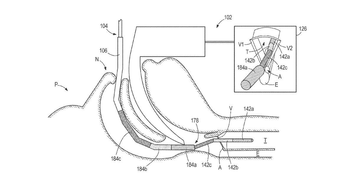 Patent drawing for Articulating stylet