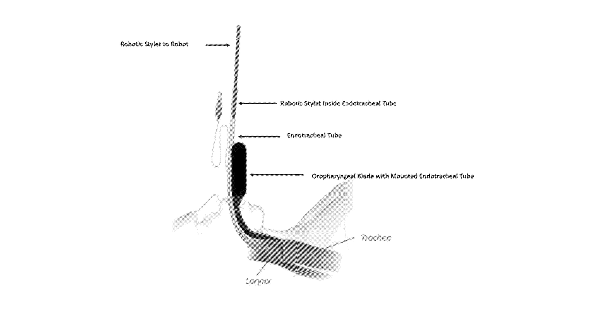 Patent drawing for Robotic artificial intelligence nasal/oral/rectal enteric tube