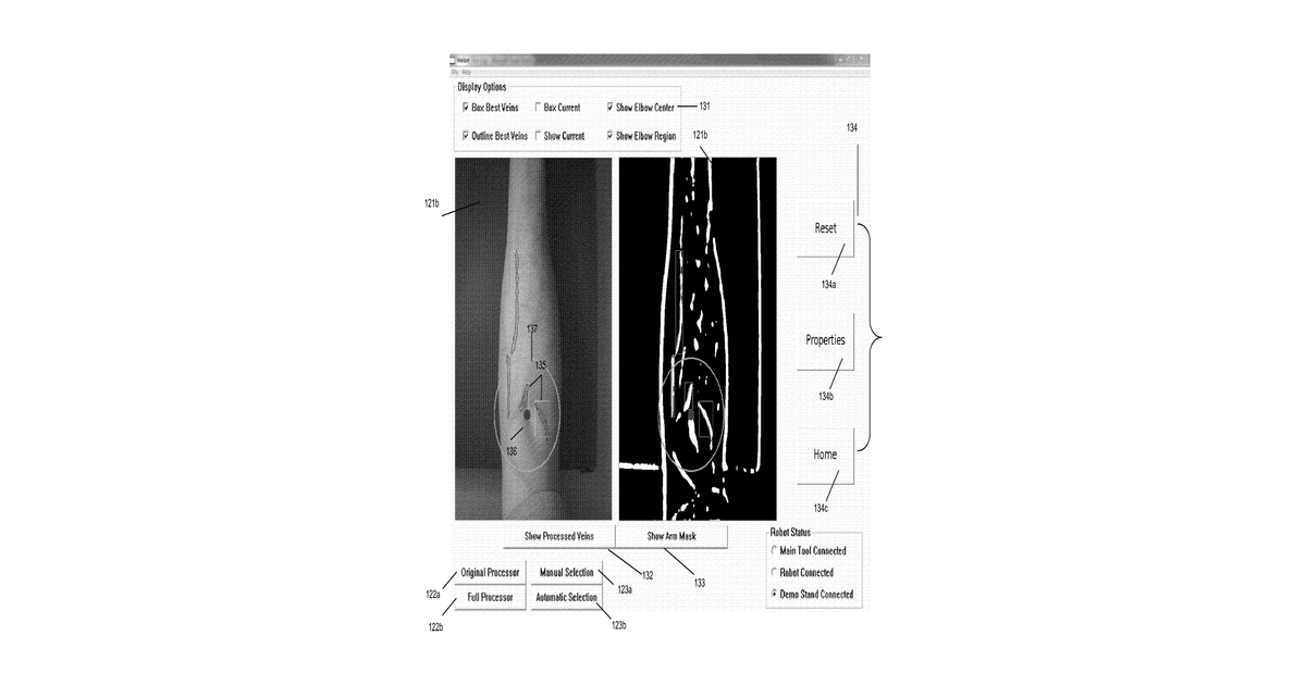 Patent drawing for Systems and methods for autonomous intravenous needle insertion