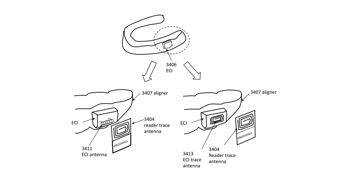 Patent drawing for Orthodontic treatment monitoring using intermediate device
