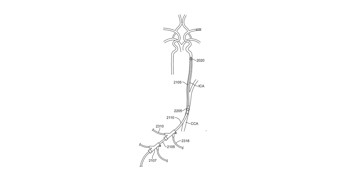 Patent drawing for Methods and systems for treatment of acute ischemic stroke