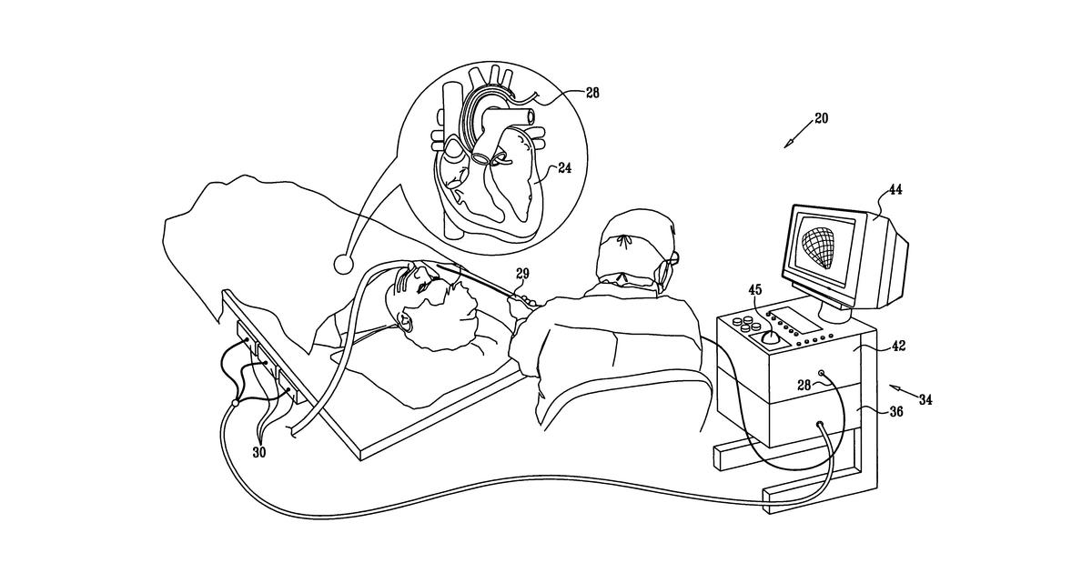 Patent drawing for Registration of electro-anatomical map with pre-acquired image using ultrasound