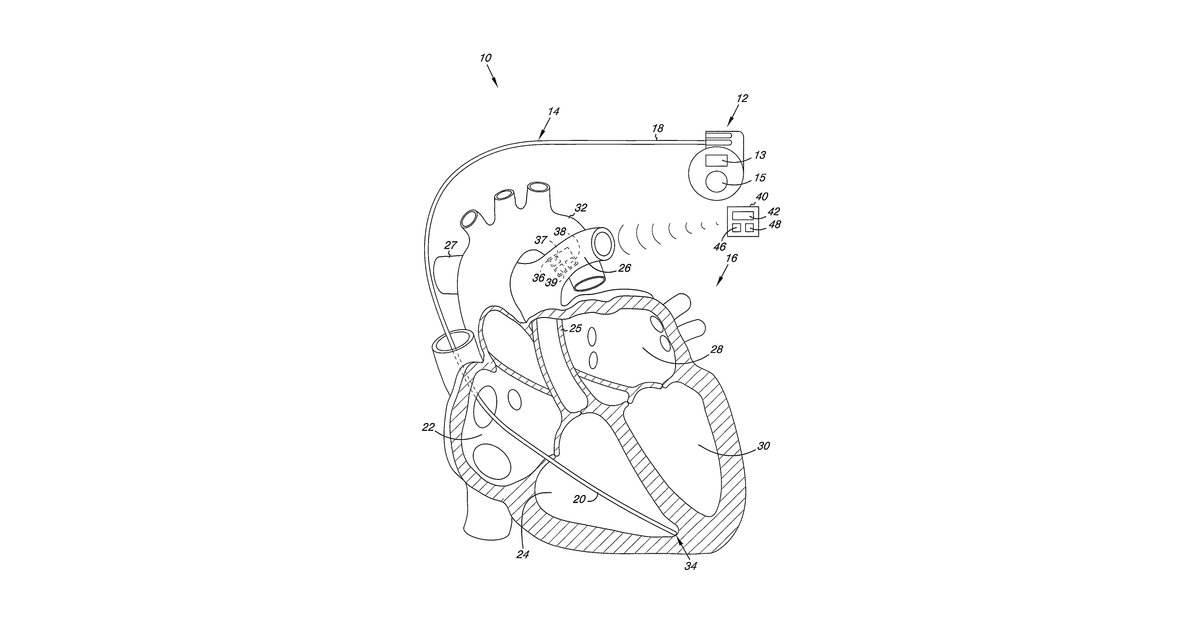 Patent drawing for Multi-element acoustic recharging system