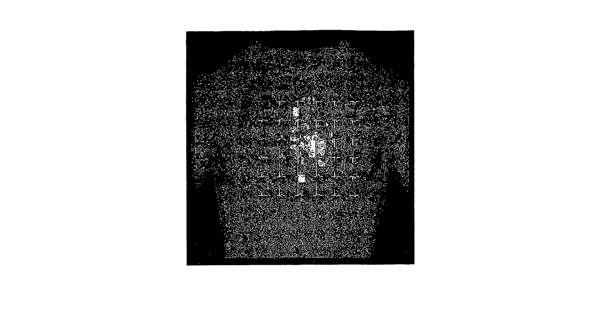 Patent drawing for Use of machine learning for classification of magneto cardiograms