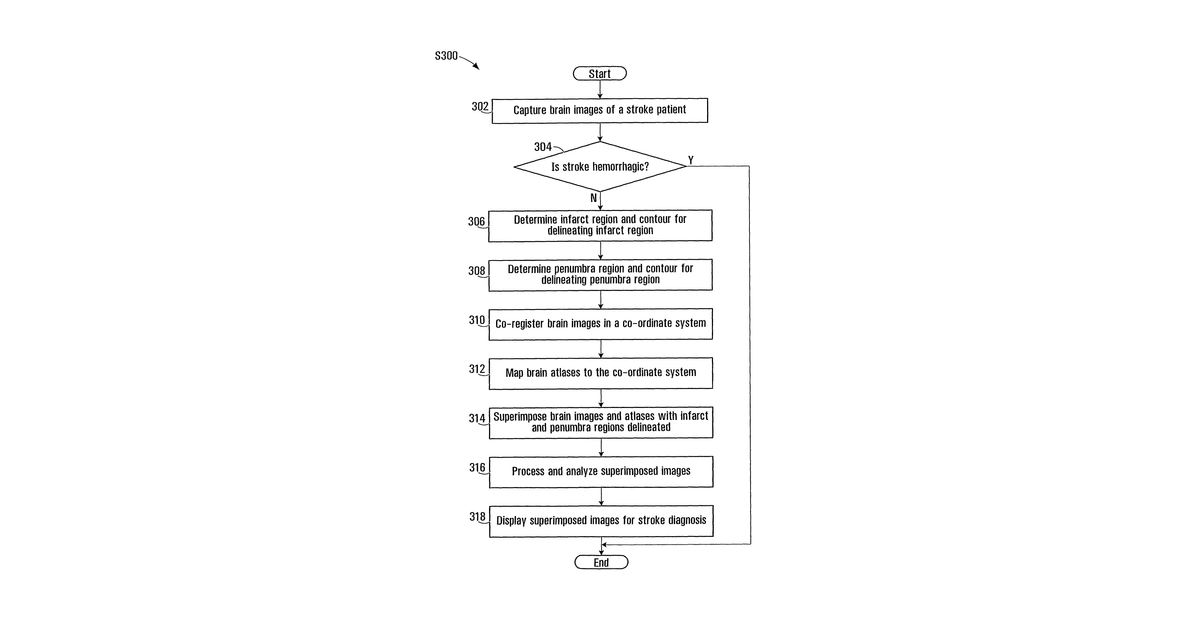 Patent drawing for Superimposing brain atlas images and brain images with delineation of infarct and penumbra for stroke diagnosis