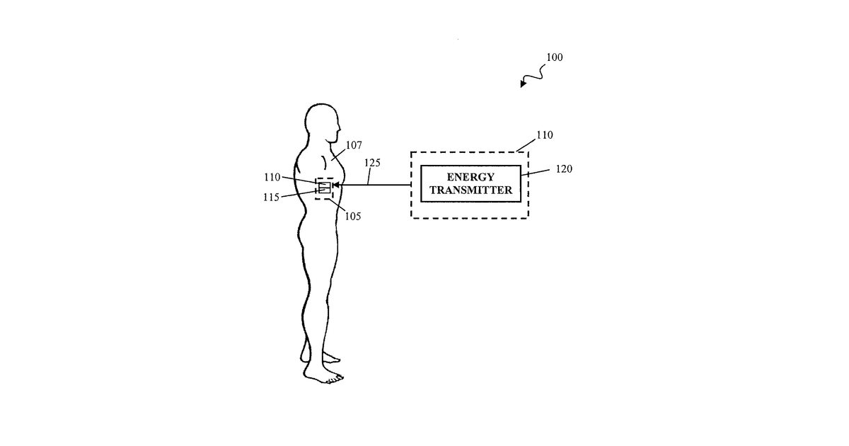 Patent drawing for Thermal management of implantable medical devices