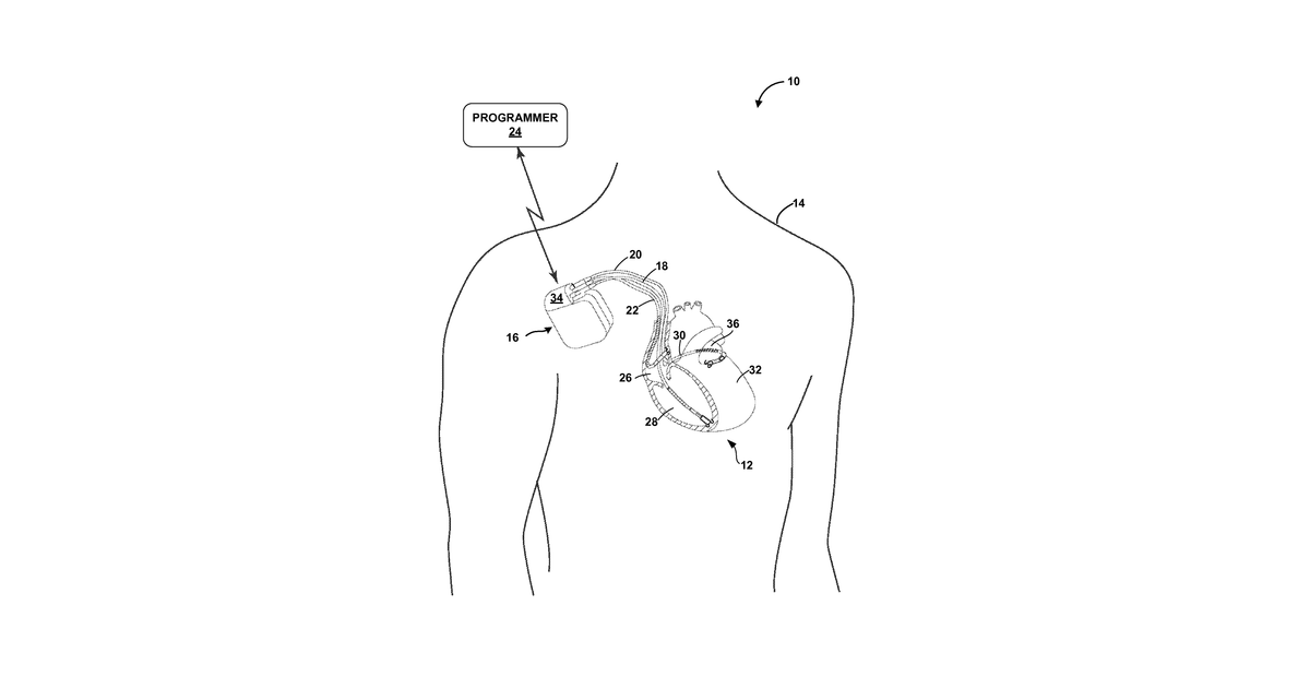 Patent drawing for Medical device programmer with adjustable kickstand