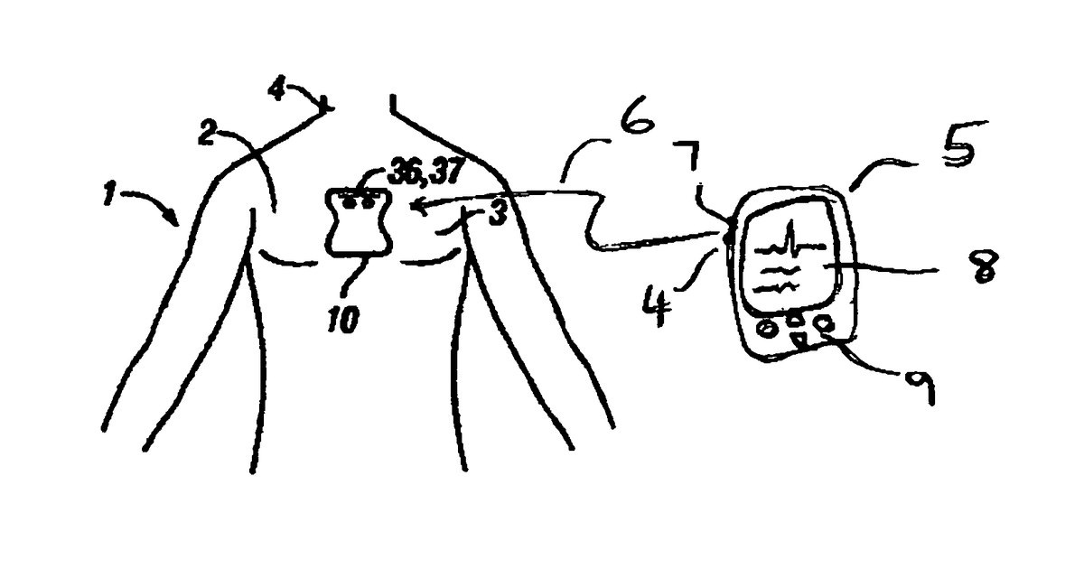 Patent drawing for Programmable ECG sensor patch