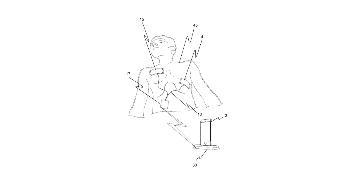 Patent drawing for Method and apparatus of remotely-operated automated external defribrallator incorporated into a handheld device