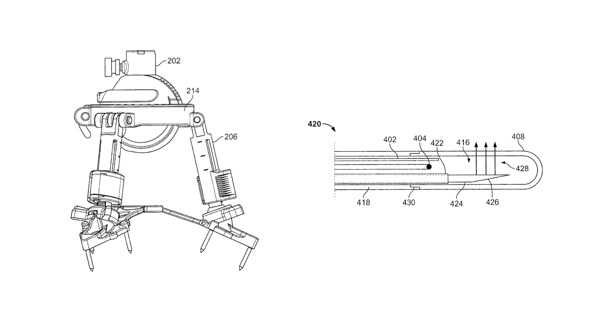 Patent drawing for Image-guide therapy of a tissue