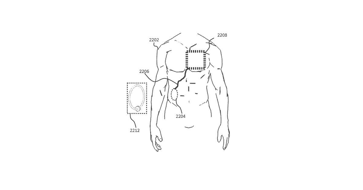 Patent drawing for Wireless energy transfer for implantable devices