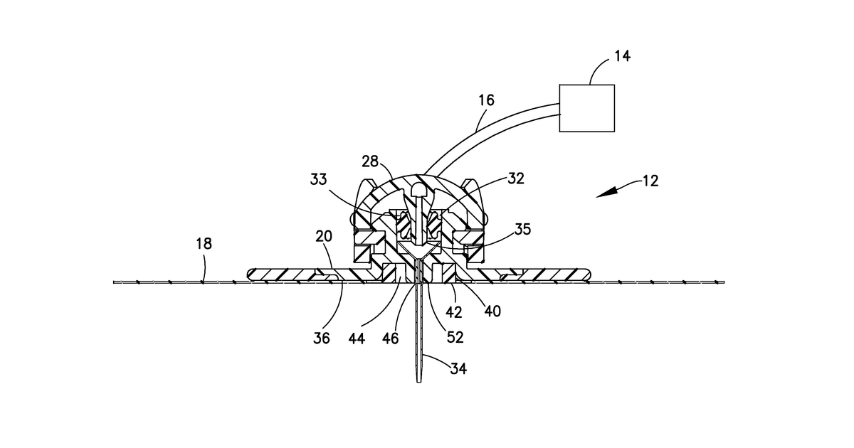 Patent drawing for Infusion site leak detection device